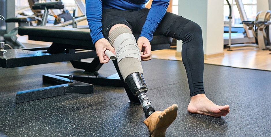 How Below Knee Prosthesis Can Help with Common Amputees